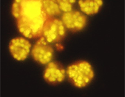 Aurantiochytrium